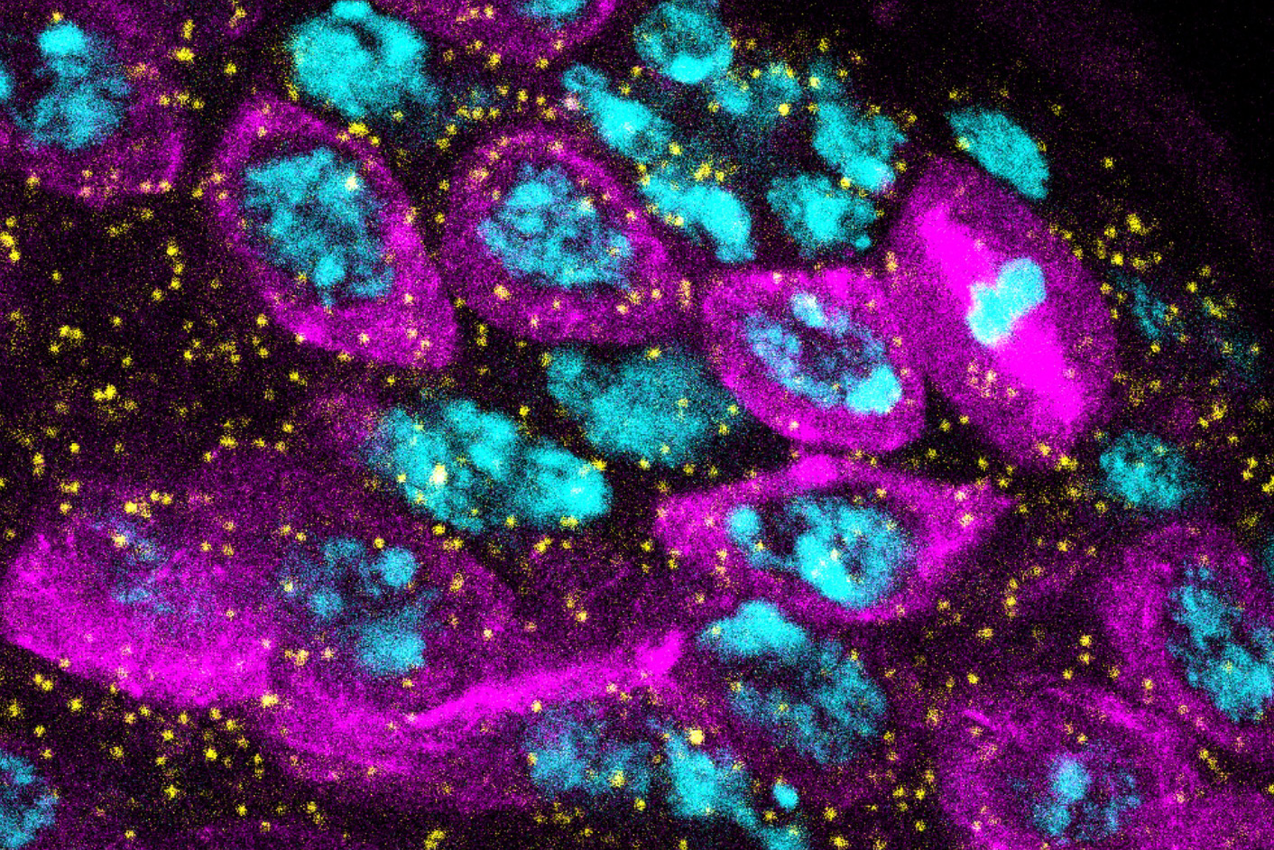 Fruit fly germ cells are visualized by germline-specific expression of Tubulin-GFP (magenta), and DNA is marked by counterstaining with DAPI (cyan). The yellow dots show expression of Stat92E, which gradually declines as the stem cells transform into sperm (Contributed image).